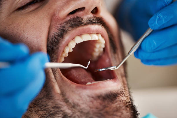 Best Broken or Chipped Tooth Repair in Mount Hore, WI